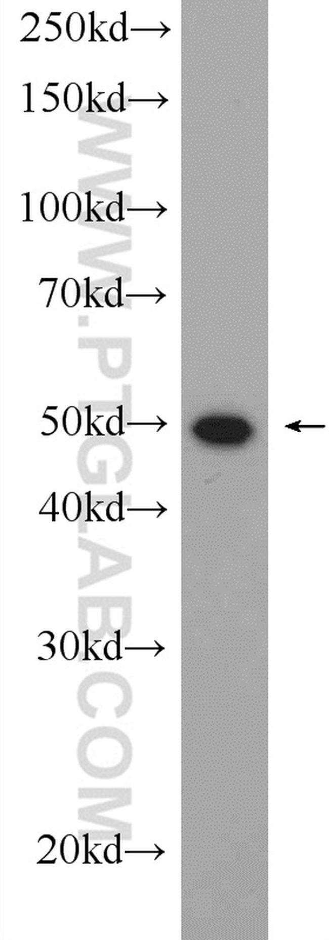 MUM1/IRF4 Antibody in Western Blot (WB)