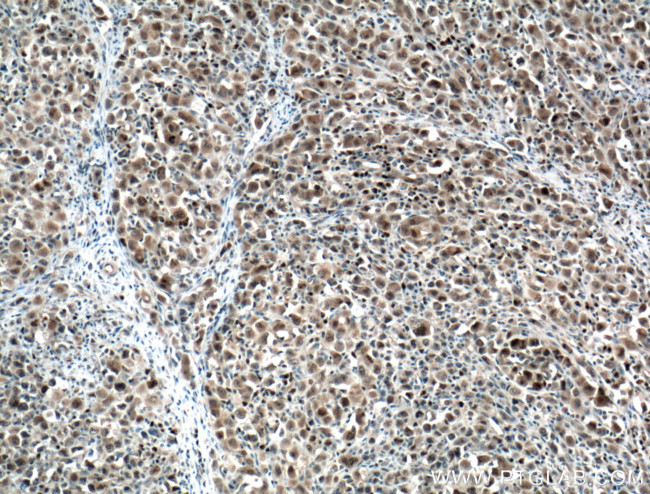 MUM1/IRF4 Antibody in Immunohistochemistry (Paraffin) (IHC (P))