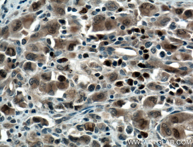 MUM1/IRF4 Antibody in Immunohistochemistry (Paraffin) (IHC (P))