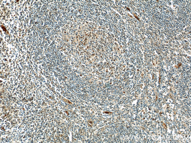 MUM1/IRF4 Antibody in Immunohistochemistry (Paraffin) (IHC (P))