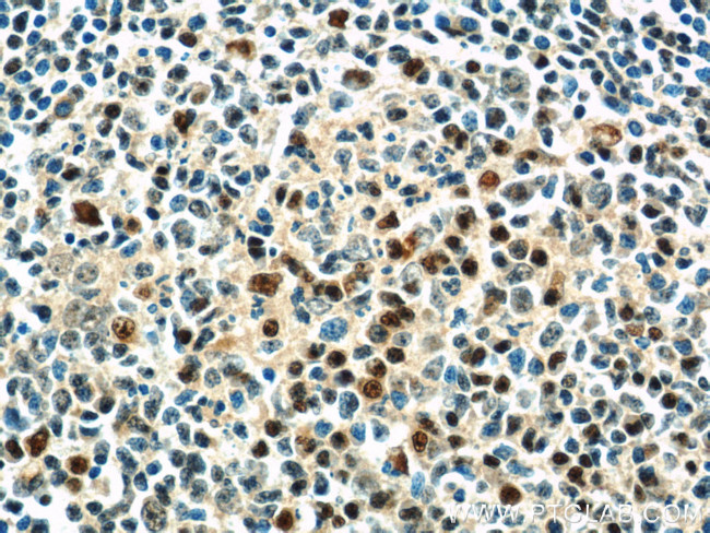 MUM1/IRF4 Antibody in Immunohistochemistry (Paraffin) (IHC (P))