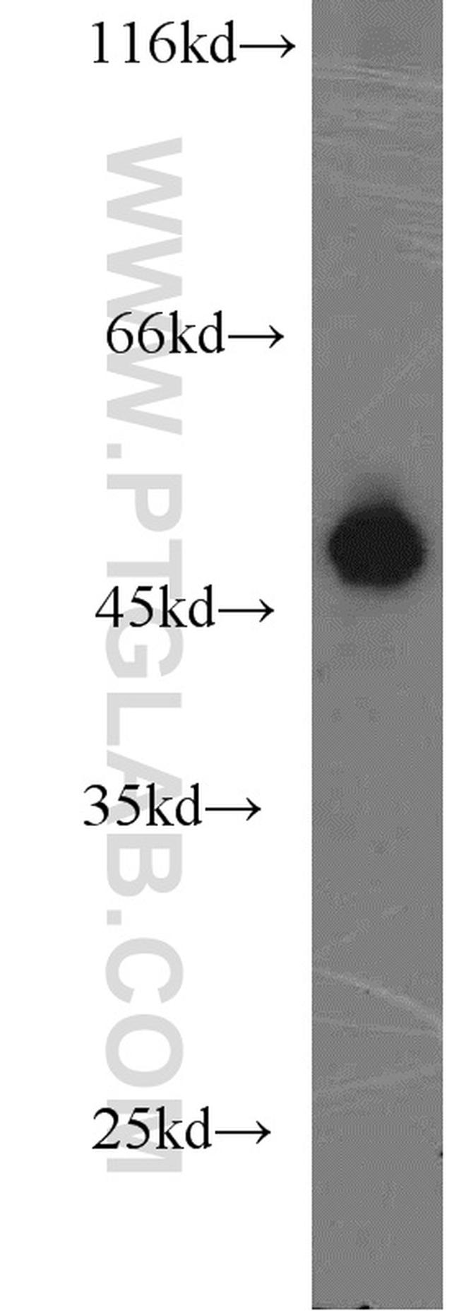 MUM1/IRF4 Antibody in Western Blot (WB)