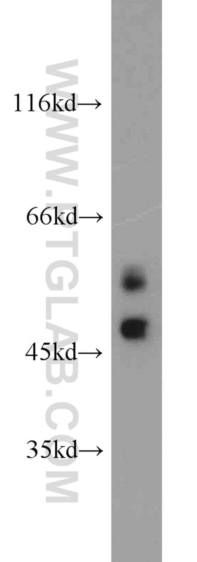 MUM1/IRF4 Antibody in Western Blot (WB)