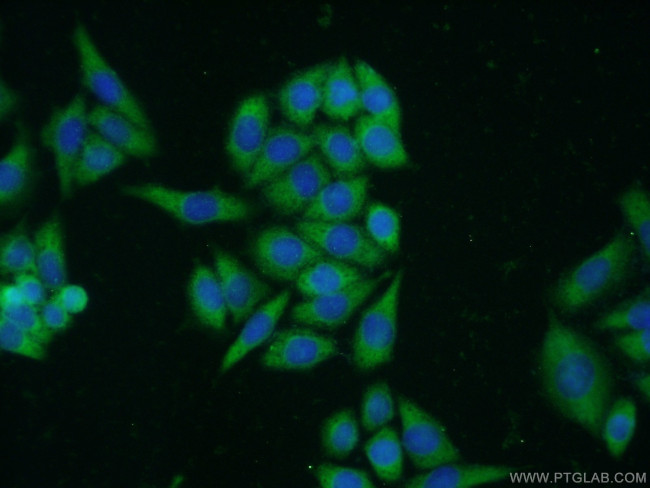 S100A10 Antibody in Immunocytochemistry (ICC/IF)