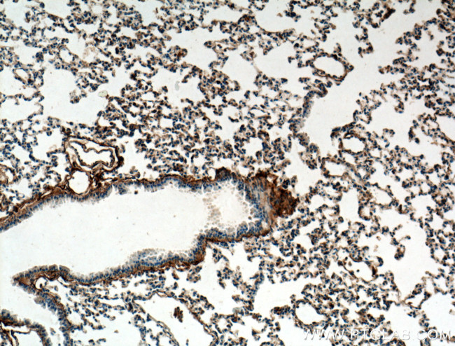 S100A10 Antibody in Immunohistochemistry (Paraffin) (IHC (P))