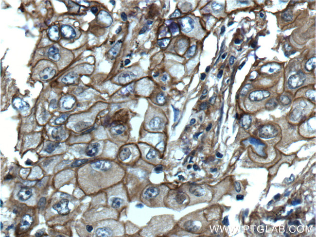 S100A10 Antibody in Immunohistochemistry (Paraffin) (IHC (P))