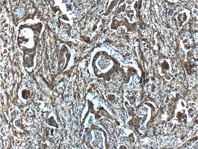 S100A10 Antibody in Immunohistochemistry (Paraffin) (IHC (P))