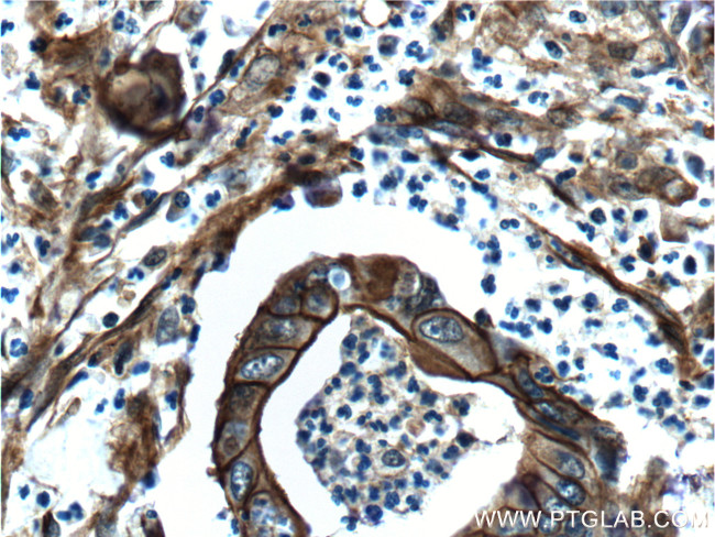 S100A10 Antibody in Immunohistochemistry (Paraffin) (IHC (P))