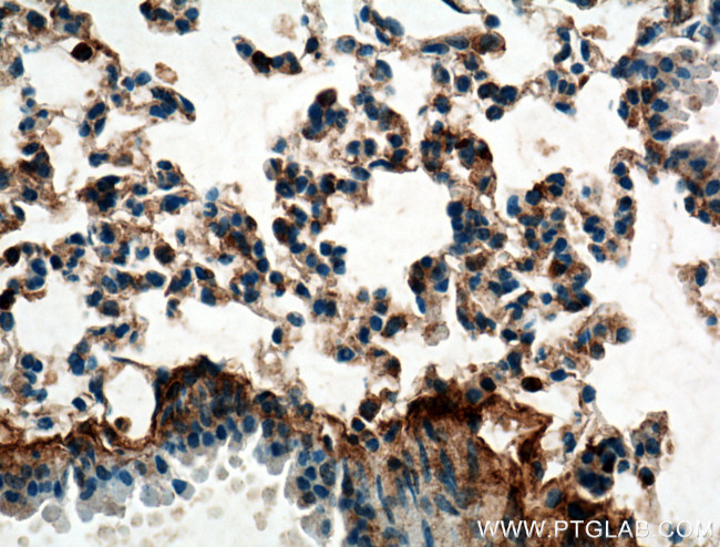 S100A10 Antibody in Immunohistochemistry (Paraffin) (IHC (P))