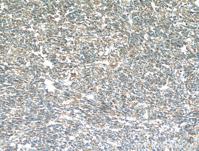 S100A10 Antibody in Immunohistochemistry (Paraffin) (IHC (P))