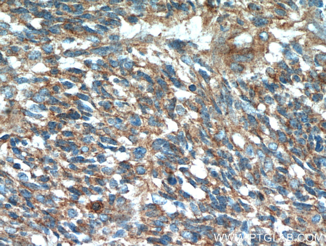 S100A10 Antibody in Immunohistochemistry (Paraffin) (IHC (P))