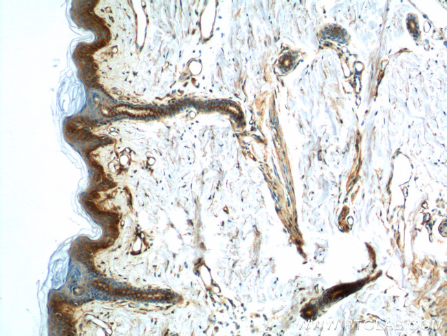 S100A10 Antibody in Immunohistochemistry (Paraffin) (IHC (P))