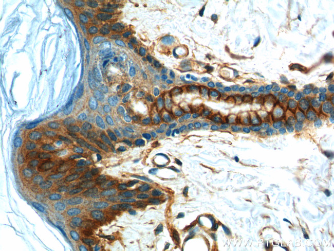 S100A10 Antibody in Immunohistochemistry (Paraffin) (IHC (P))