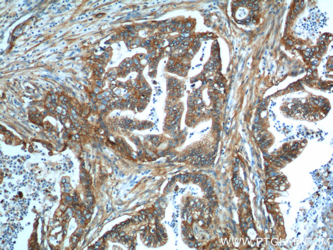 S100A10 Antibody in Immunohistochemistry (Paraffin) (IHC (P))