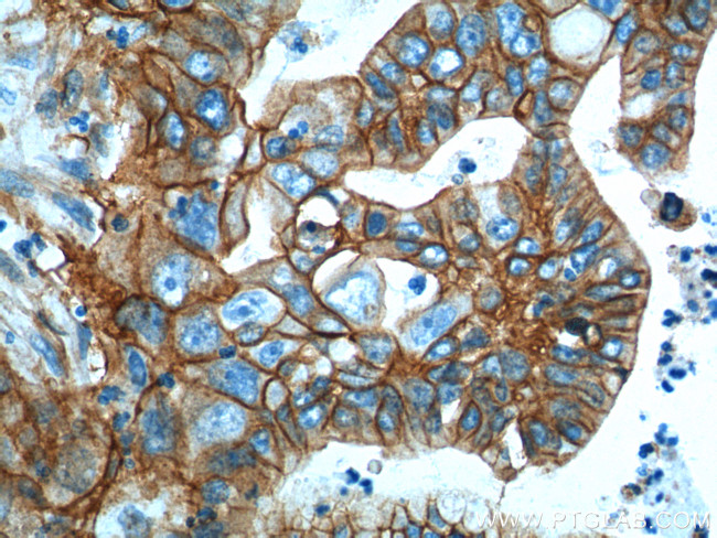 S100A10 Antibody in Immunohistochemistry (Paraffin) (IHC (P))