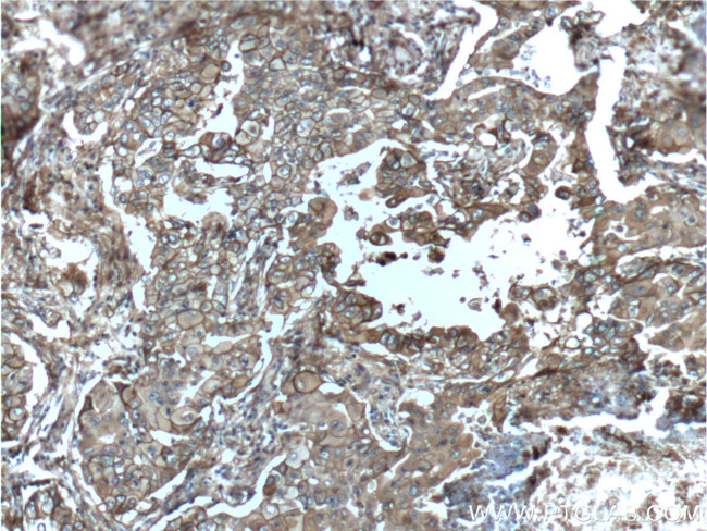 S100A10 Antibody in Immunohistochemistry (Paraffin) (IHC (P))