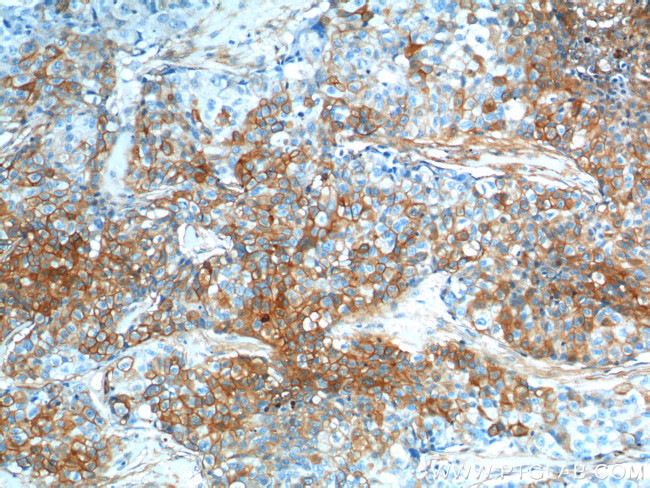 S100A10 Antibody in Immunohistochemistry (Paraffin) (IHC (P))