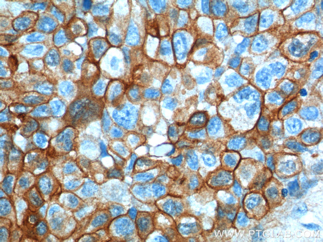 S100A10 Antibody in Immunohistochemistry (Paraffin) (IHC (P))