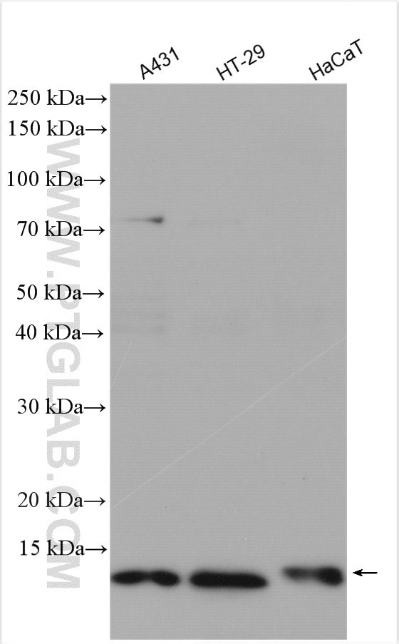 S100A10 Antibody in Western Blot (WB)