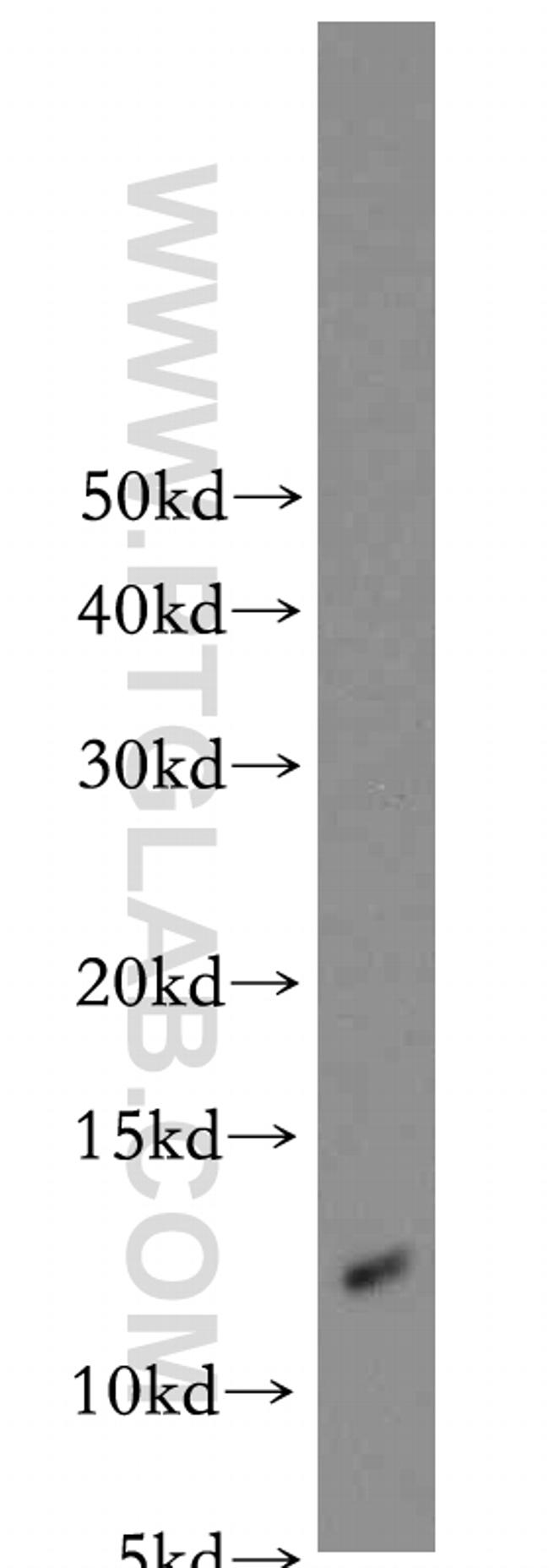 S100A10 Antibody in Western Blot (WB)