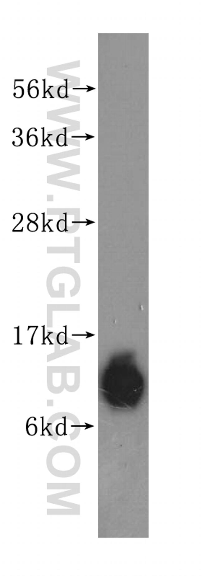 S100A10 Antibody in Western Blot (WB)