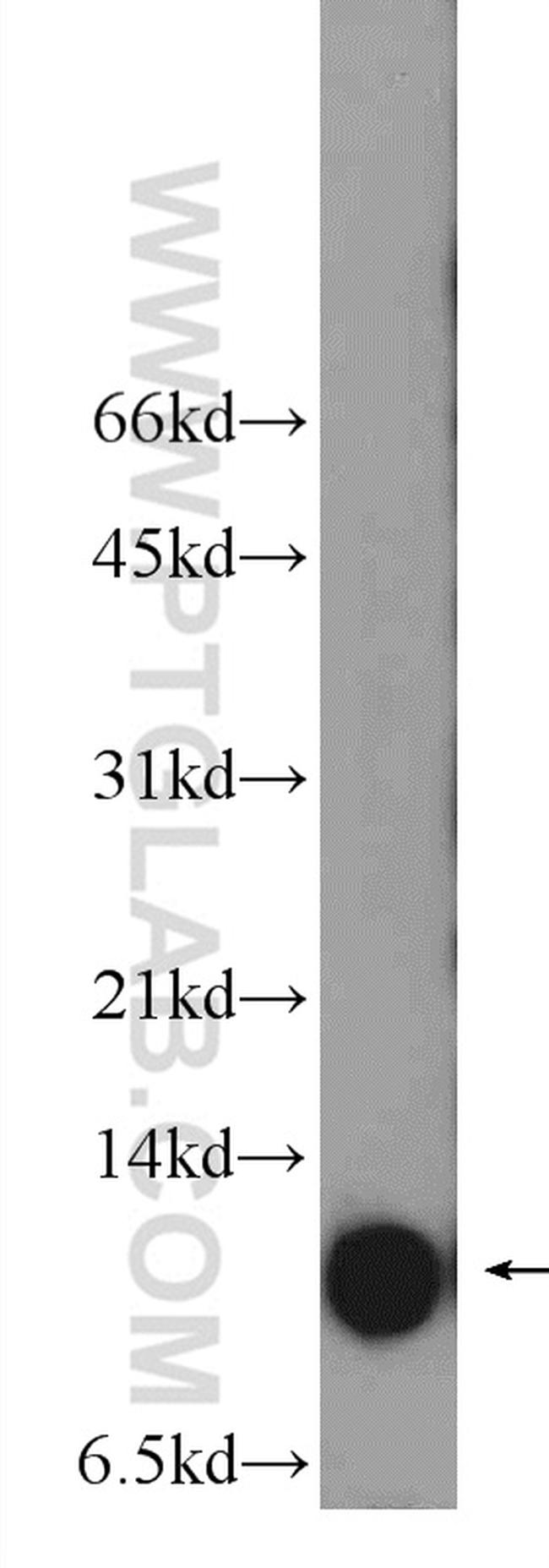 S100A10 Antibody in Western Blot (WB)