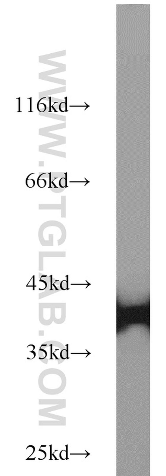 SUMO2/3 Antibody in Western Blot (WB)