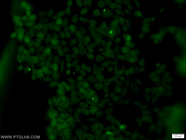 SUMO2/3 Antibody in Immunocytochemistry (ICC/IF)