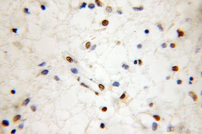 SUMO2/3 Antibody in Immunohistochemistry (Paraffin) (IHC (P))