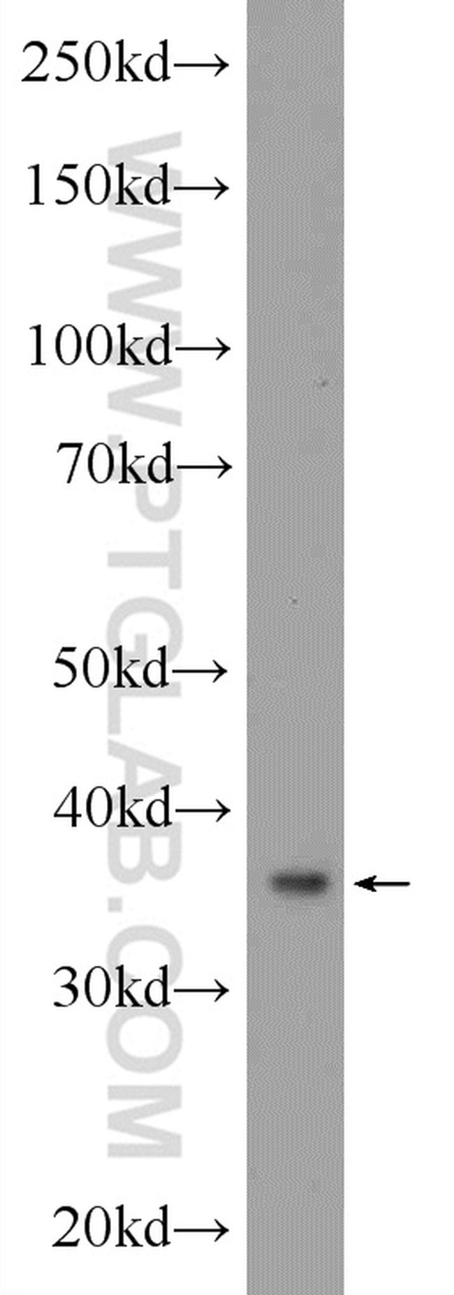 GLRX3 Antibody in Western Blot (WB)