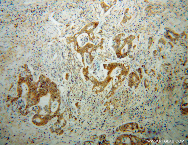 GLRX3 Antibody in Immunohistochemistry (Paraffin) (IHC (P))