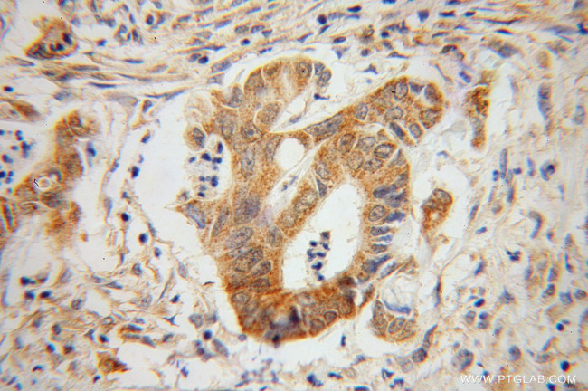 GLRX3 Antibody in Immunohistochemistry (Paraffin) (IHC (P))