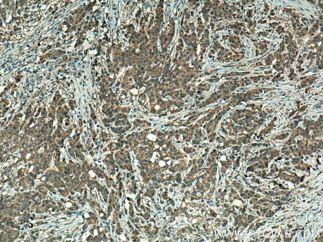 GLRX3 Antibody in Immunohistochemistry (Paraffin) (IHC (P))