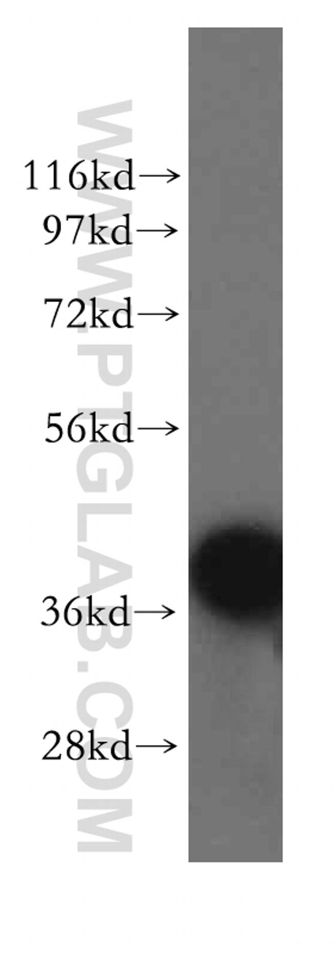 RAD51AP1 Antibody in Western Blot (WB)