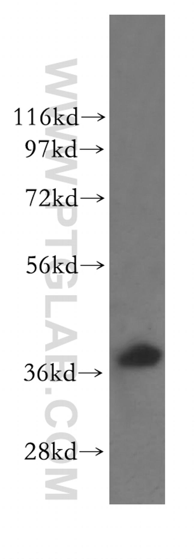 RAD51AP1 Antibody in Western Blot (WB)