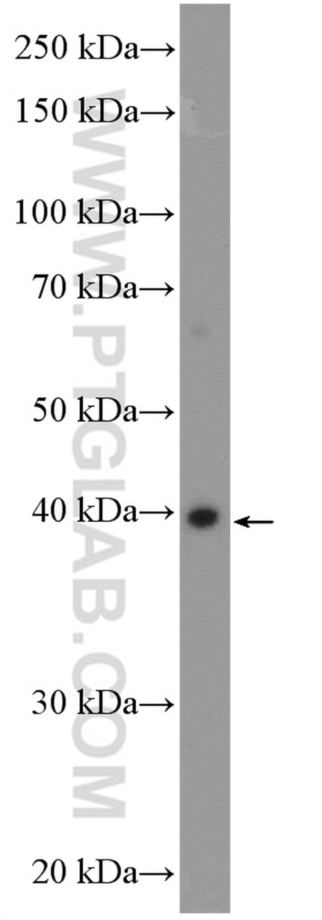 RAD51AP1 Antibody in Western Blot (WB)