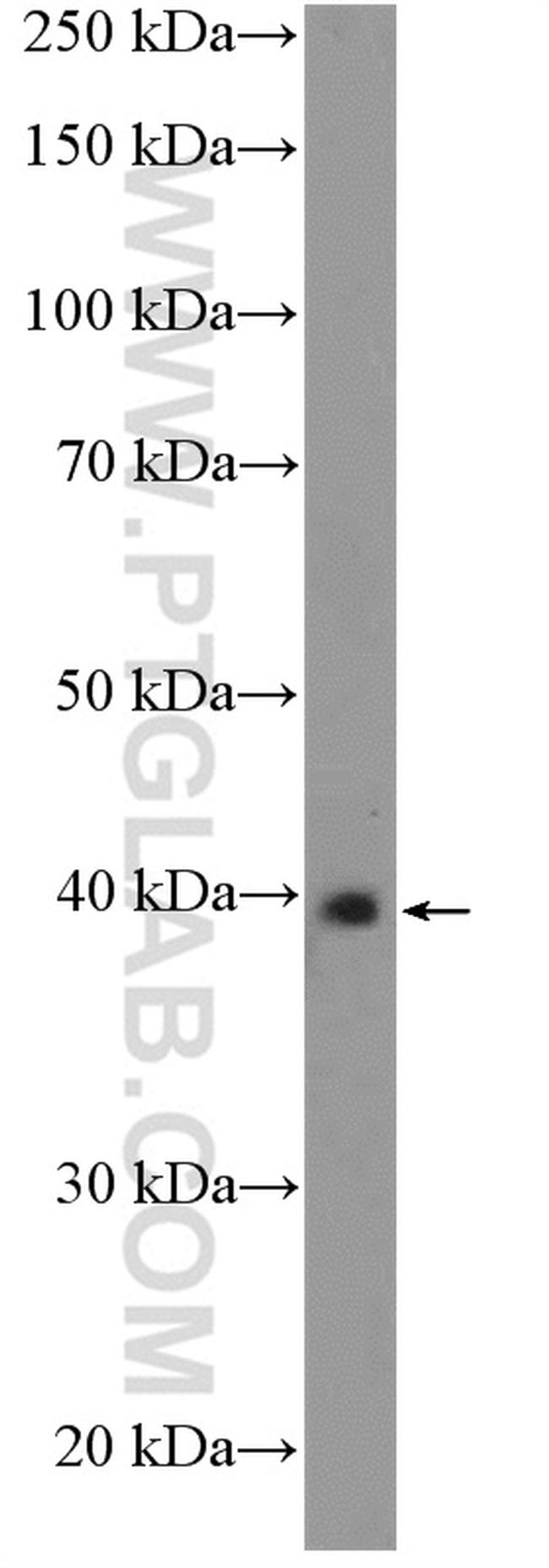RAD51AP1 Antibody in Western Blot (WB)