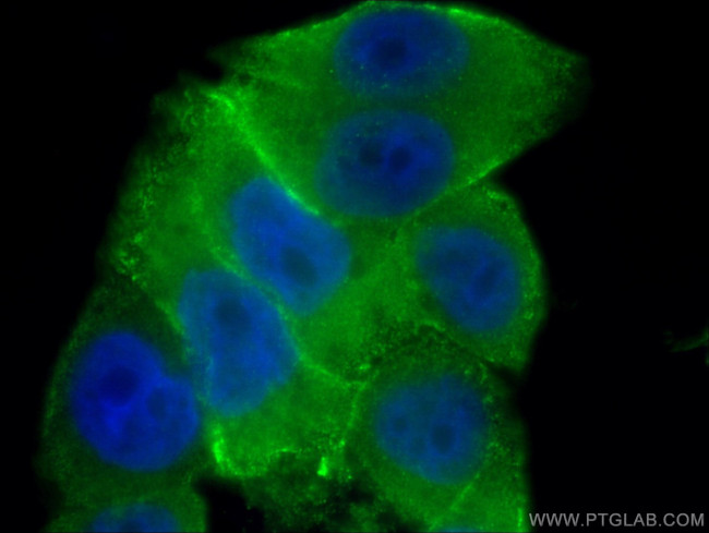 Annexin A2 Antibody in Immunocytochemistry (ICC/IF)