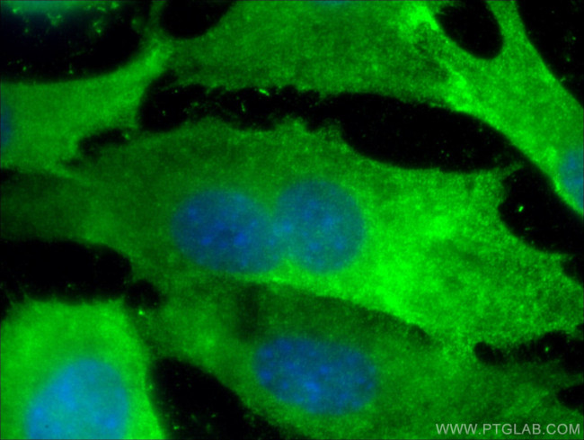 Annexin A2 Antibody in Immunocytochemistry (ICC/IF)