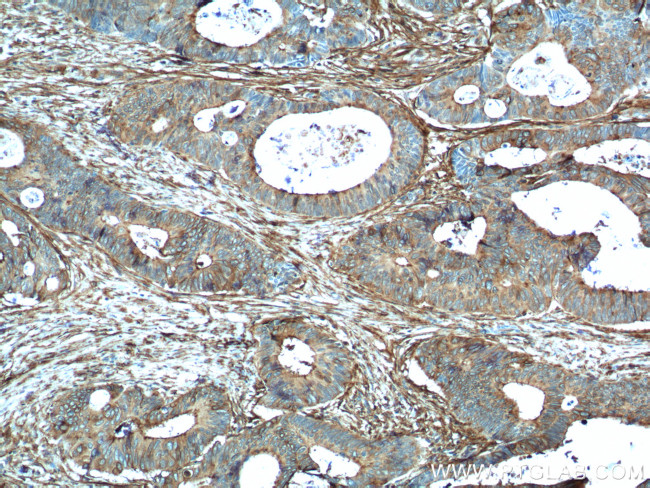 Annexin A2 Antibody in Immunohistochemistry (Paraffin) (IHC (P))