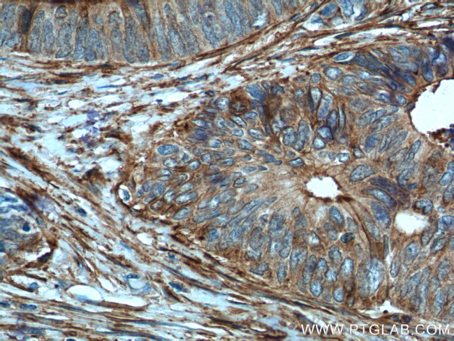 Annexin A2 Antibody in Immunohistochemistry (Paraffin) (IHC (P))