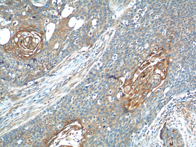 Annexin A2 Antibody in Immunohistochemistry (Paraffin) (IHC (P))