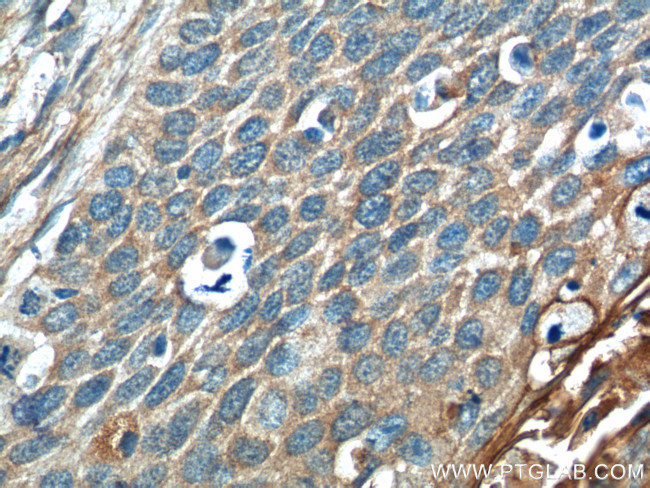 Annexin A2 Antibody in Immunohistochemistry (Paraffin) (IHC (P))