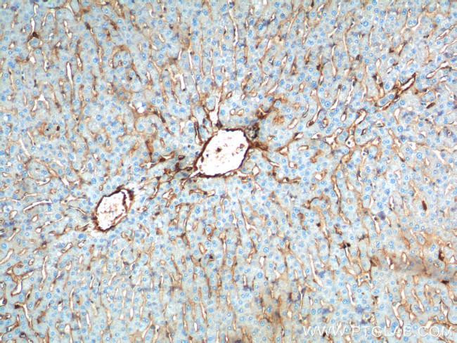 Annexin A2 Antibody in Immunohistochemistry (Paraffin) (IHC (P))