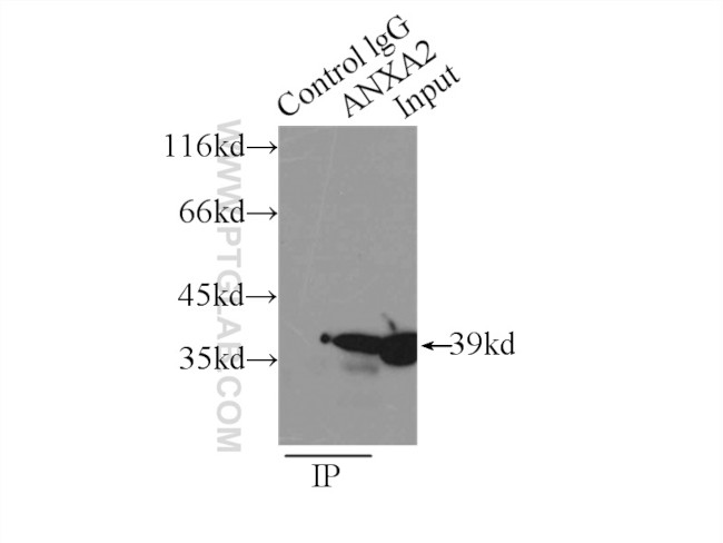 Annexin A2 Antibody in Immunoprecipitation (IP)