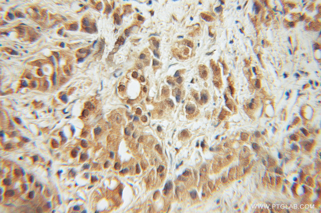 ERK1/2 Antibody in Immunohistochemistry (Paraffin) (IHC (P))