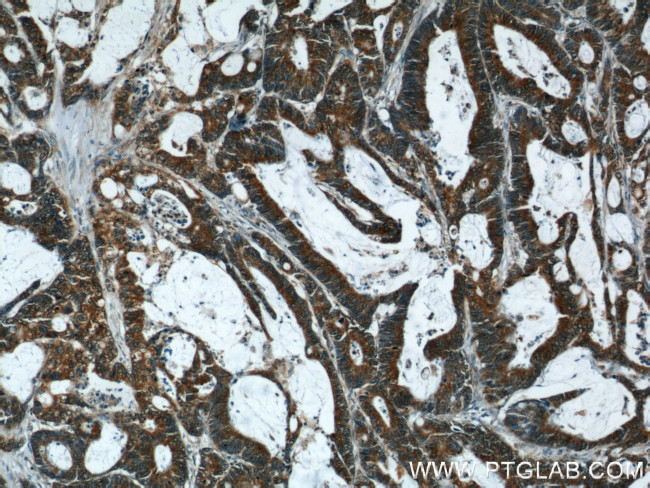 ERK1/2 Antibody in Immunohistochemistry (Paraffin) (IHC (P))