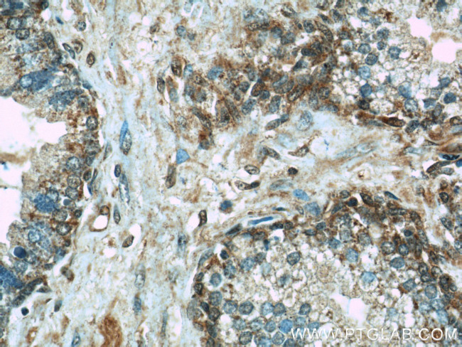 ERK1/2 Antibody in Immunohistochemistry (Paraffin) (IHC (P))