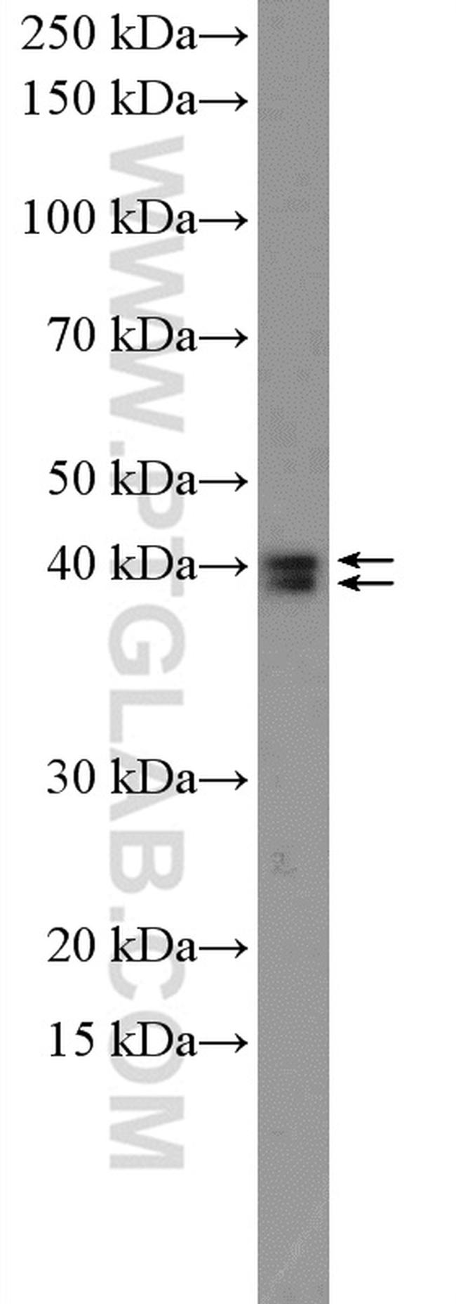 ERK1/2 Antibody in Western Blot (WB)