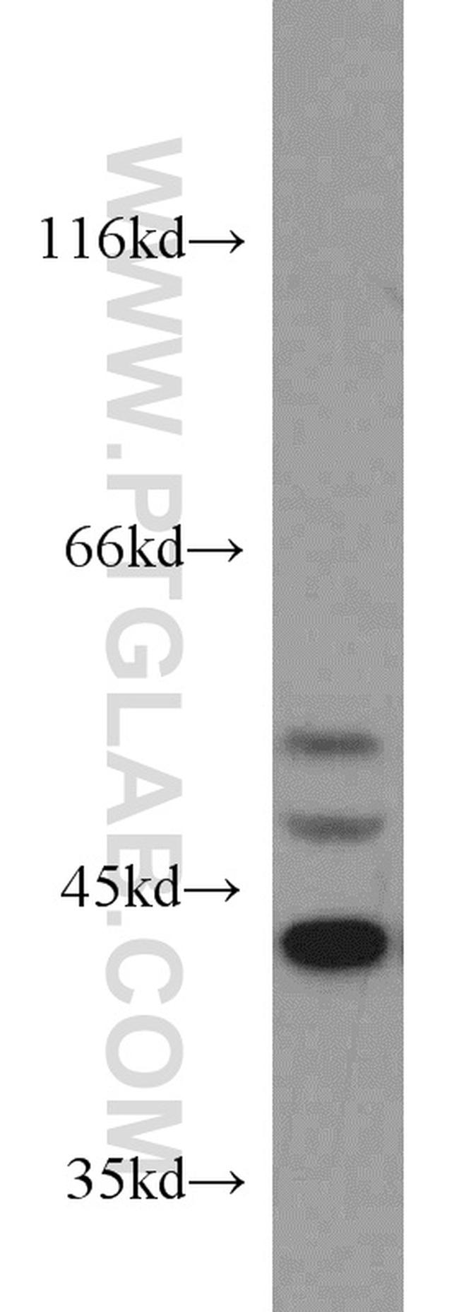 ERK1/2 Antibody in Western Blot (WB)